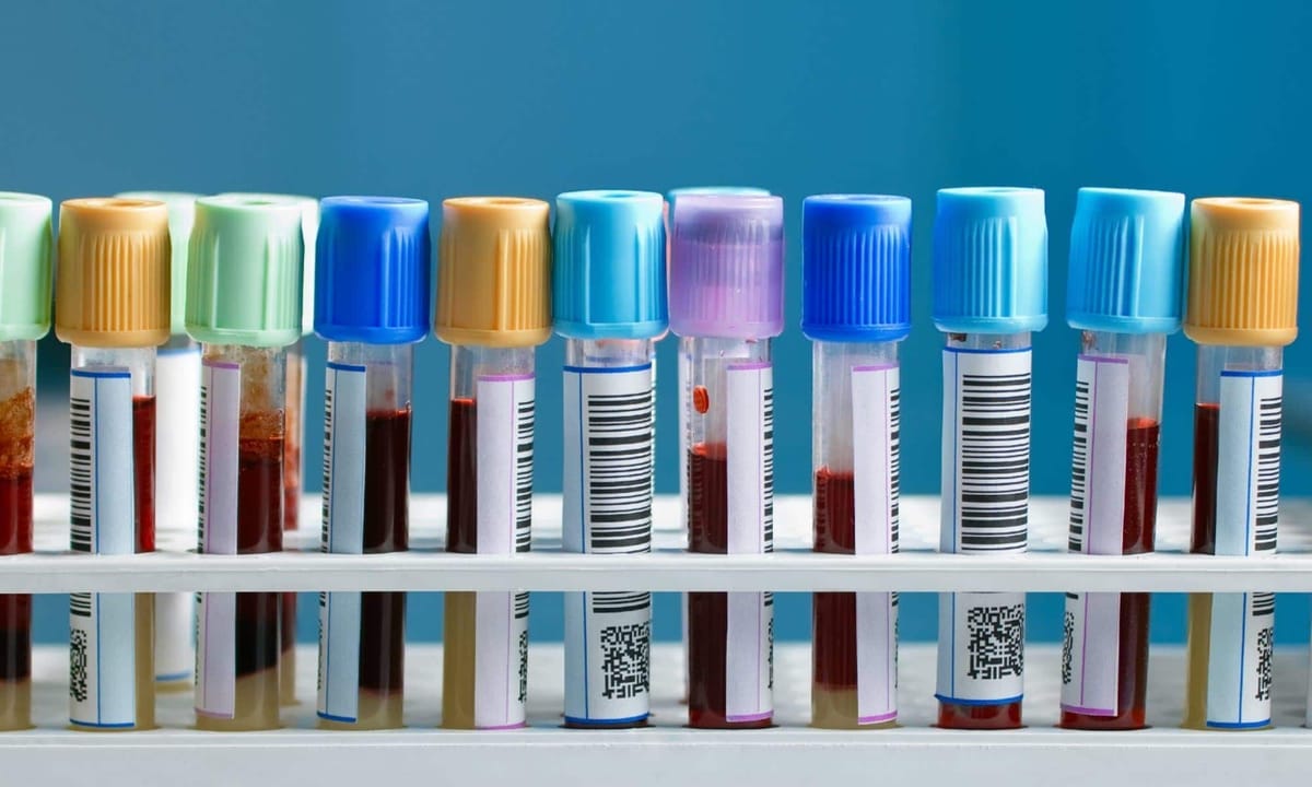 Dès le 10 février 2015, c'est dans l'ancien Des Laurentides Ford que sera situé le centre de prélèvements de l'Hôpital région